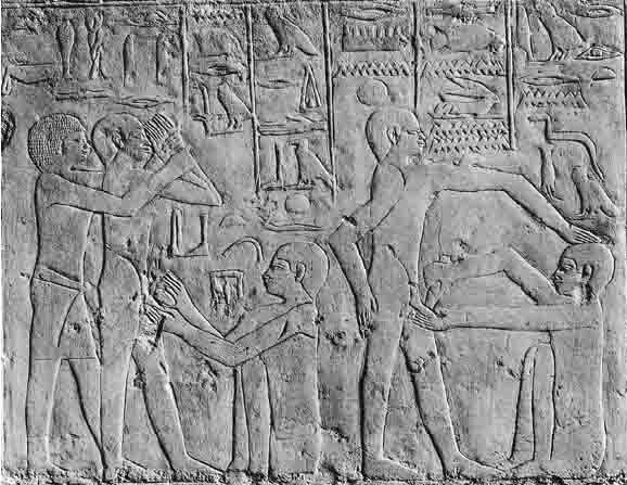 تاریخچه ختنه